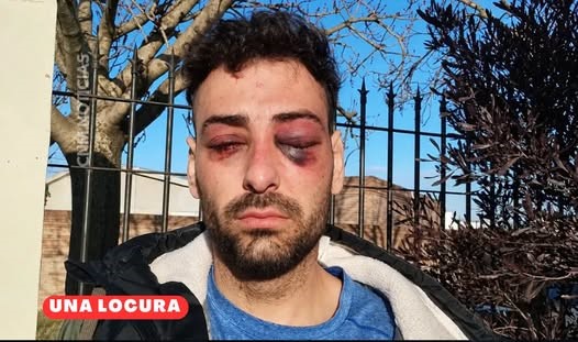 Un docente brutalmente golpeado por policía de La Pampa